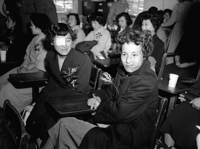 Mitsuko Kuranoto (kiri) dan Emiko Takemoto, adalah korban yang selamat dari bom atom Hiroshima yang terjadi 10 tahun sebelumnya. Dalam kesempatan ini, dia sedang berada di pangkalan Angkatan Udara Mitchel di Long Island, New York, 9 Mei 1955. Dua puluh lima orang gadis Jepang, yang terluka karena bom atom tersebut, terbang sejauh 11000 ke New York dengan harapan keajaiban operasi plastik dapat memberikan mereka wajah yang baru. (Photo by Jacob Harris/AP Photo via The Atlantic)