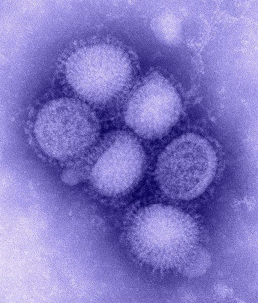 Uniknya Patung Virus dan Bakteri Yang Terbuat Dari Kaca