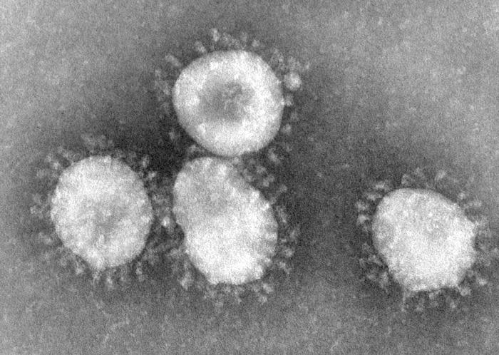 Uniknya Patung Virus dan Bakteri Yang Terbuat Dari Kaca
