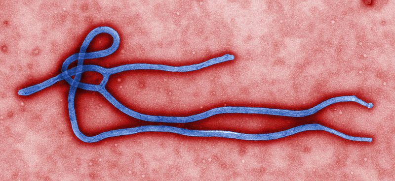Uniknya Patung Virus dan Bakteri Yang Terbuat Dari Kaca