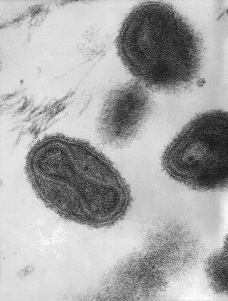 Uniknya Patung Virus dan Bakteri Yang Terbuat Dari Kaca