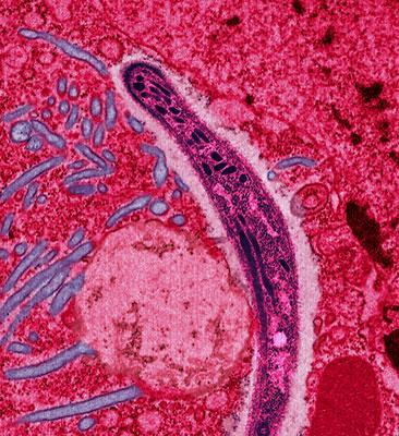 Uniknya Patung Virus dan Bakteri Yang Terbuat Dari Kaca