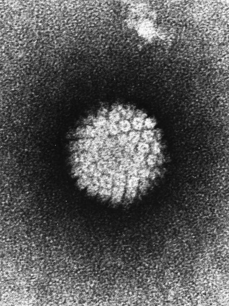 Uniknya Patung Virus dan Bakteri Yang Terbuat Dari Kaca